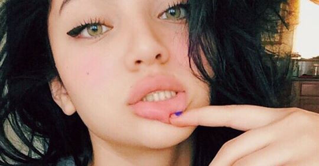 Met deze 7 tips zijn droge lippen verleden tijd