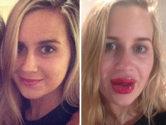 VIDEO: meisje wilde Kylie Jenner lippen (maar dit is wat ze kreeg)