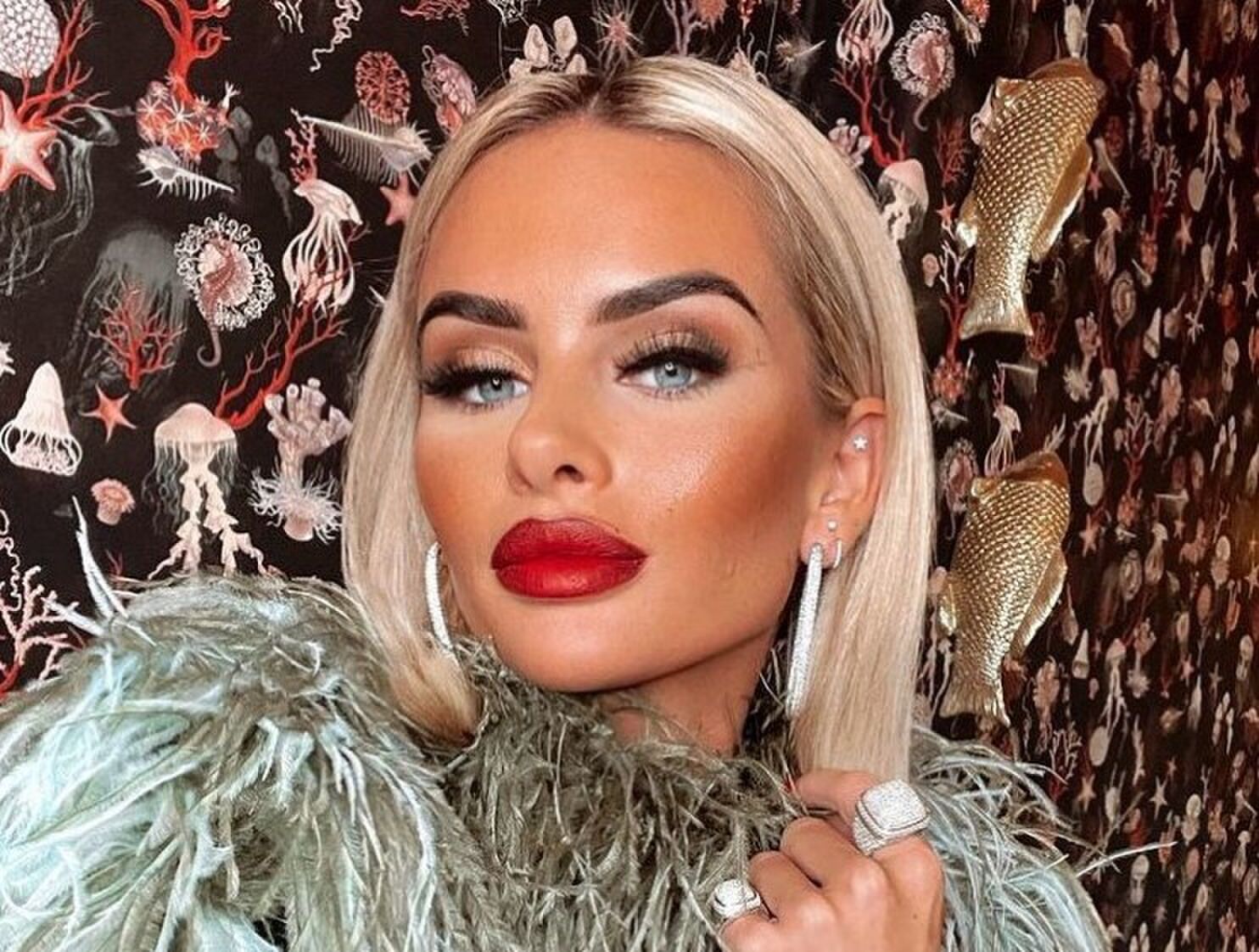 Plastic fantastic: deze ingrepen heeft Sarah van Soelen allemaal gehad