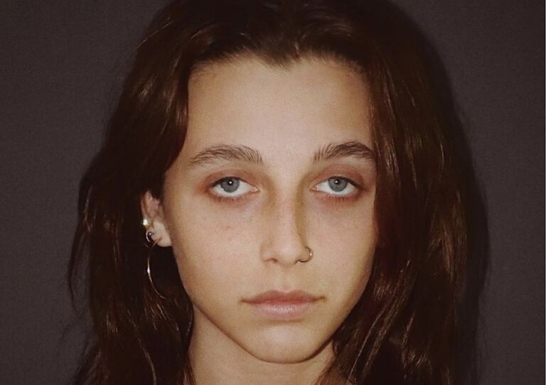 Wat? Dit is de nieuwe beauty trend: donkere kringen onder je ogen