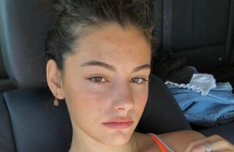 Good to know! Zo haal je zelf een gerstekorrel weg