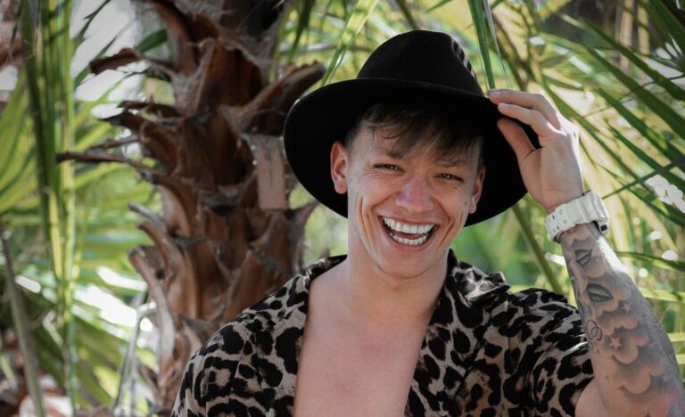 Dusty van Ex On The Beach krijgt veel negatieve reacties op zijn haartransplantatie