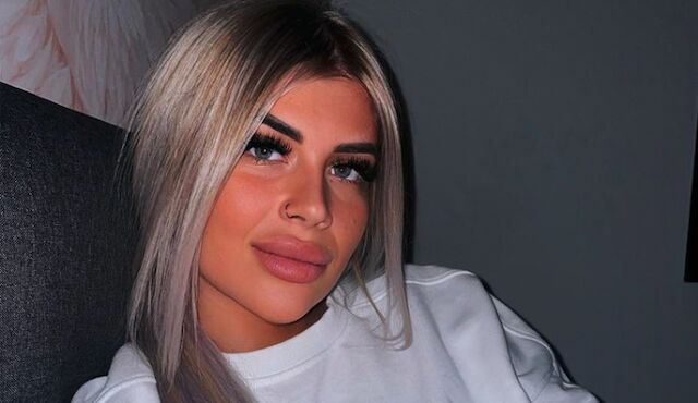 EOTB-Shani ondergaat cosmetische ingreep in Turkije