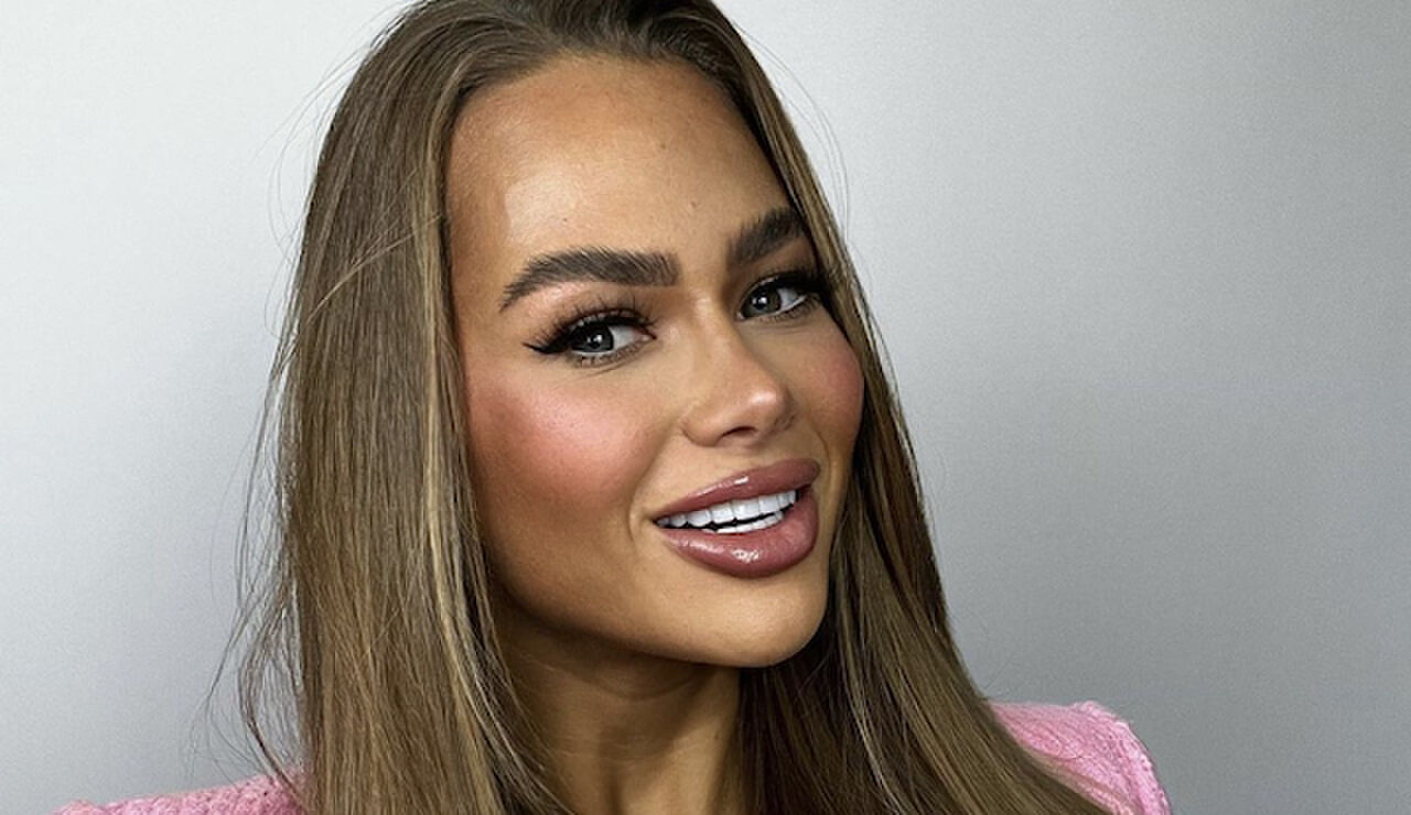 Zien! Annebel Visscher heeft (alweer) haar lippen laten doen