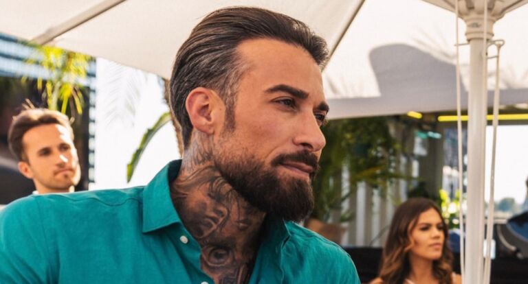 OMG: Fabrizio Tzinaridis is onherkenbaar na nieuwe ingreep