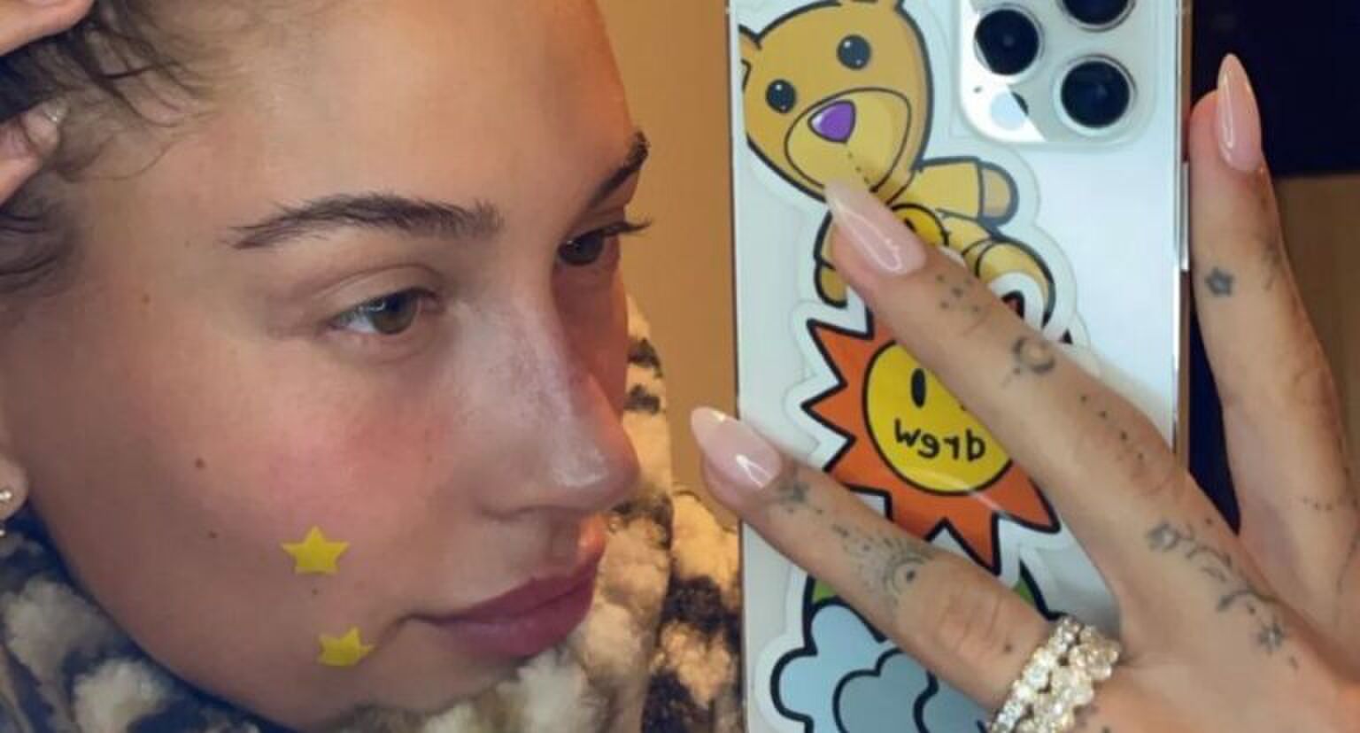 Pimple patches zijn in: en dit zijn de 3 leukste