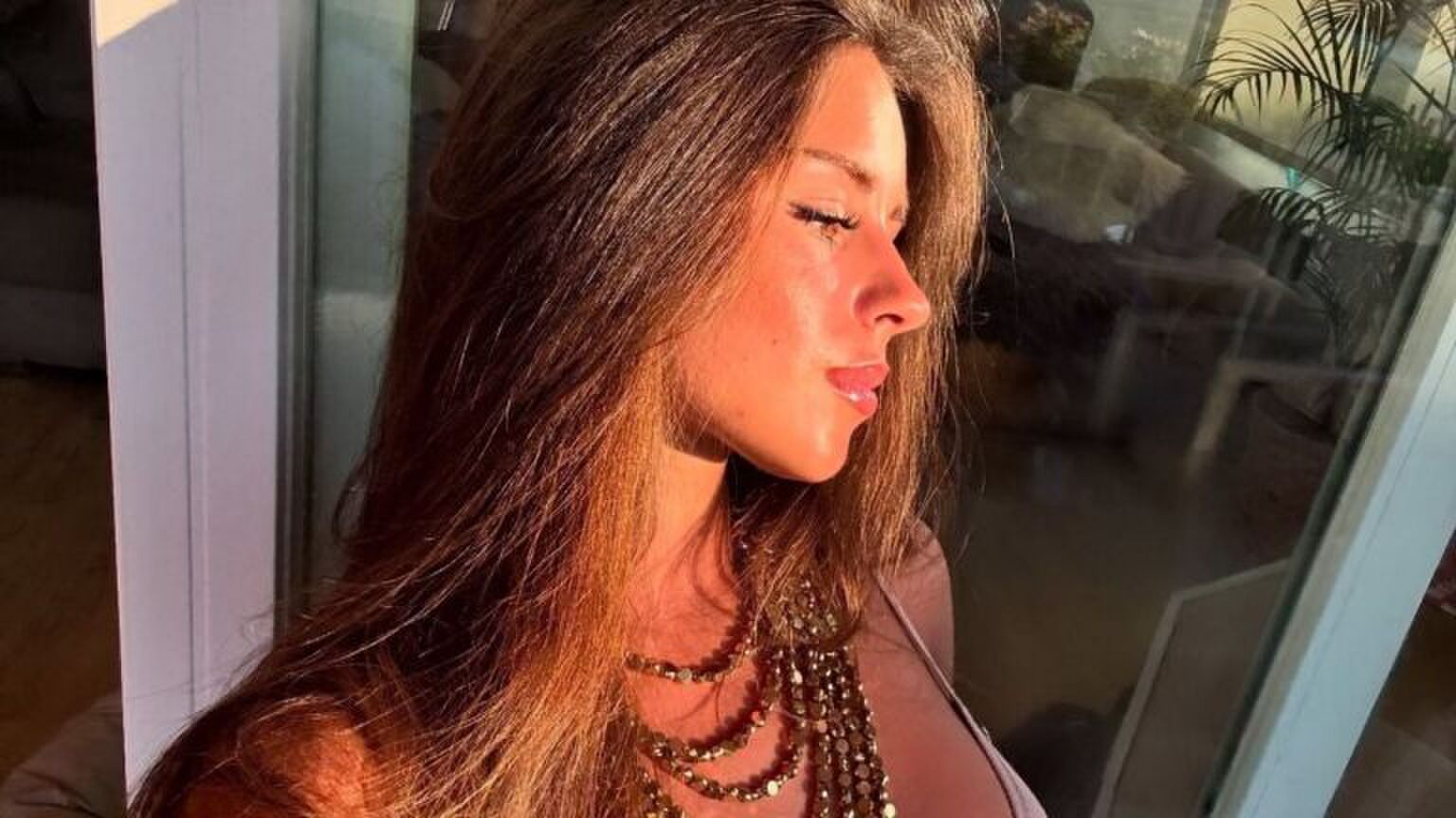 Een vrouw die lichtelijk verbrand is.