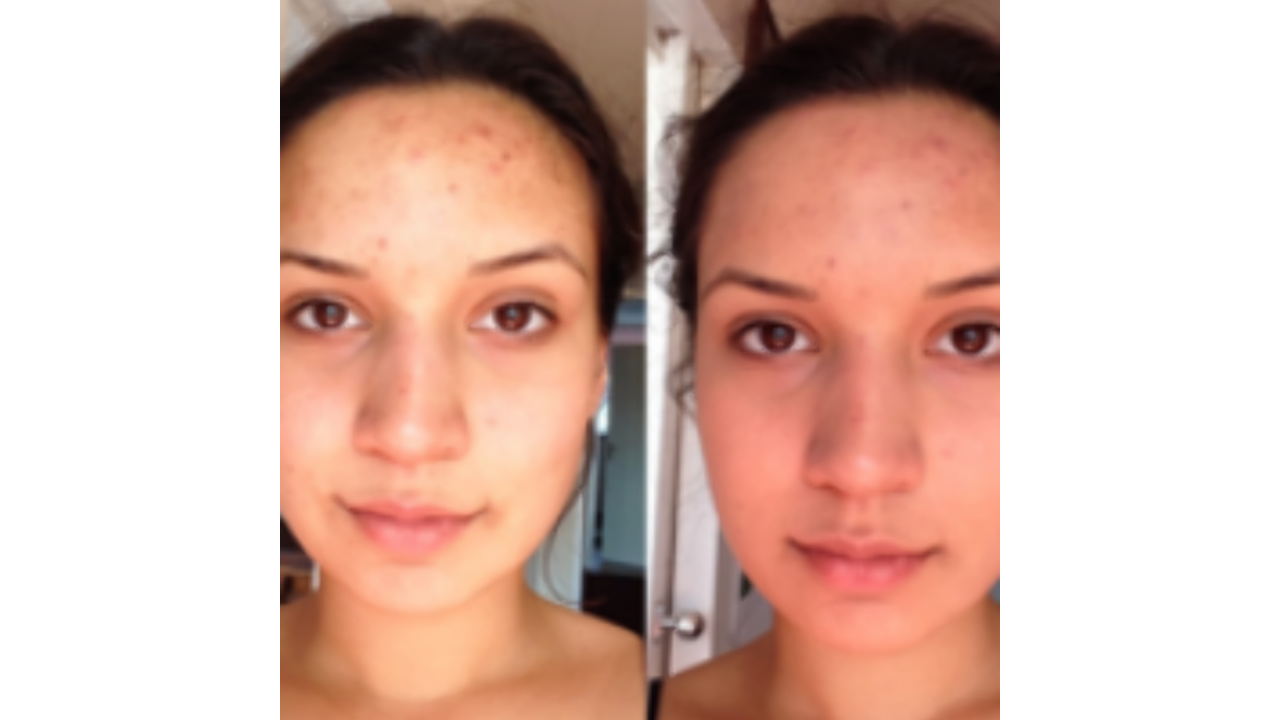 Illustratie voor: Girlscene-lezeressen testen Garnier Pure Active
