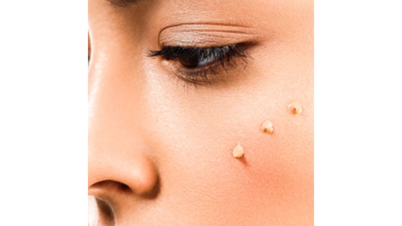 Illustratie voor: Wist je dat je hier ook concealer aan moet brengen?