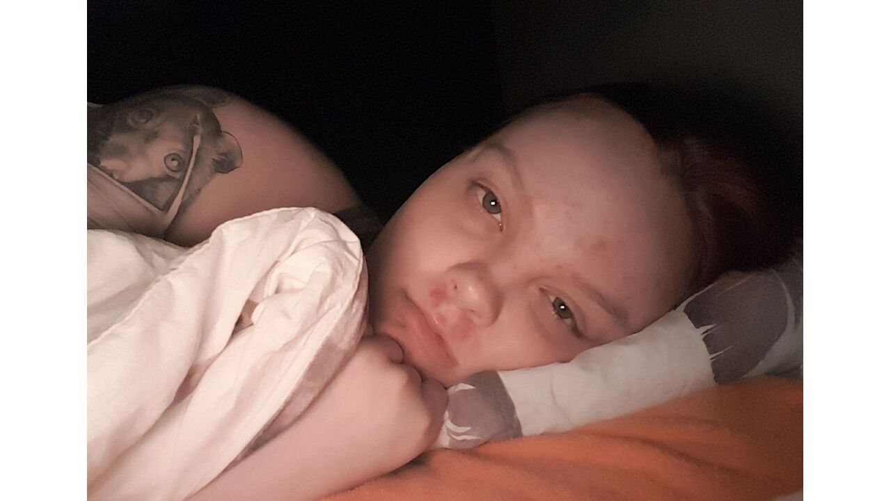 Illustratie voor: Demi (20) is zo ziek dat ze de laatste drie jaar amper haar bed is uitgekomen