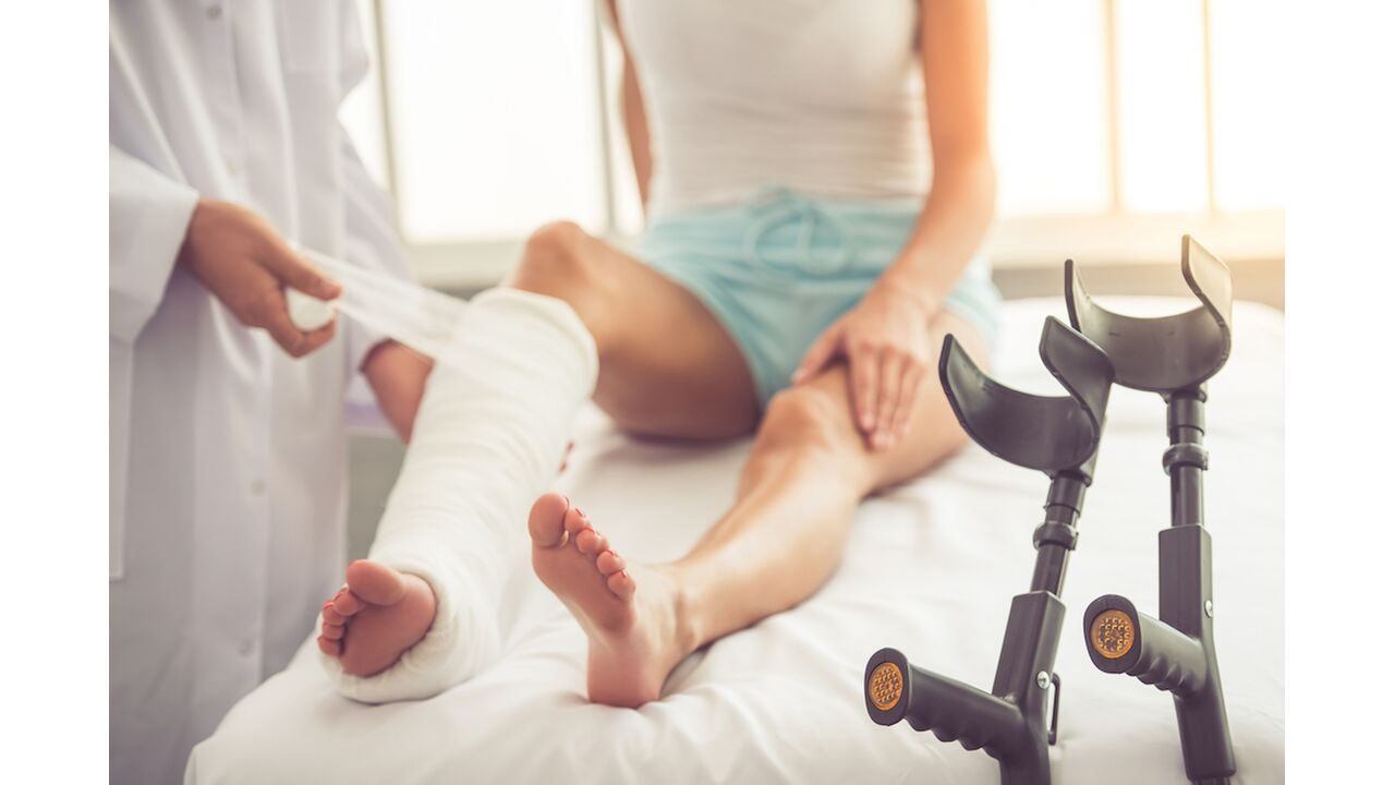 Illustratie voor: 13 dingen die jij herkent als je ooit gips hebt gehad