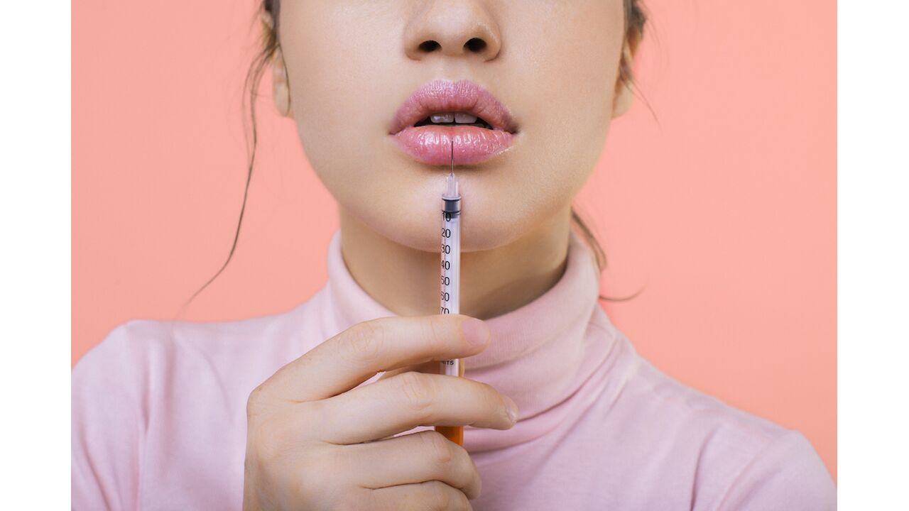 Illustratie voor: Botoxklinieken benaderen influencers voor gratis ingrepen