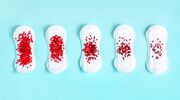 Illustratie voor: Dit is de reden waarom je menstruatiebloed bruin kan zijn