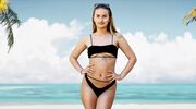 Illustratie voor: Ex On The Beach-Imke ondergaat drie cosmetische ingrepen en haar volgers kregen een kijkje in de kliniek