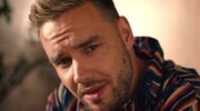 liam-payne-botox-one-direction