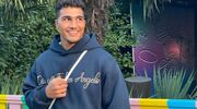 love-island-mert-haartransplantatie