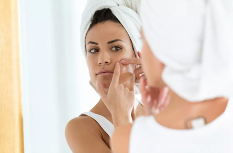 Illustratie voor: Dit is hormonale acne en dit is de oplossing ervoor