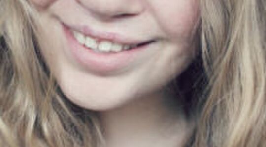 Illustratie voor: Inspirerend verhaal: Anne had een hazenlip