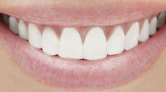 Illustratie voor: Terug van weggeweest: Oil pulling