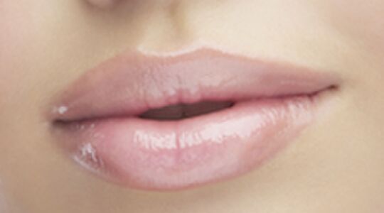 Illustratie voor: De manier om je lippen voller te maken zonder de injecties… of niet?