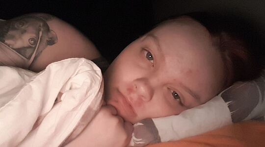 Illustratie voor: Demi (20) is zo ziek dat ze de laatste drie jaar amper haar bed is uitgekomen