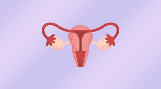 Foto van een baarmoeder.