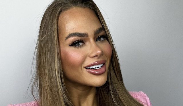 Zien! Annebel Visscher heeft (alweer) haar lippen laten doen