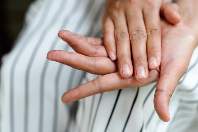 Z&oacute; kom jij van je gespleten nagels af