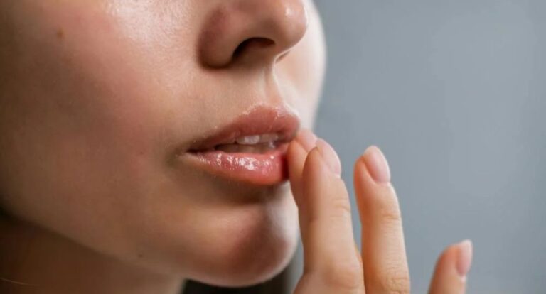 Vrouw doet lippenbalsem op haar lippen met haar hand.