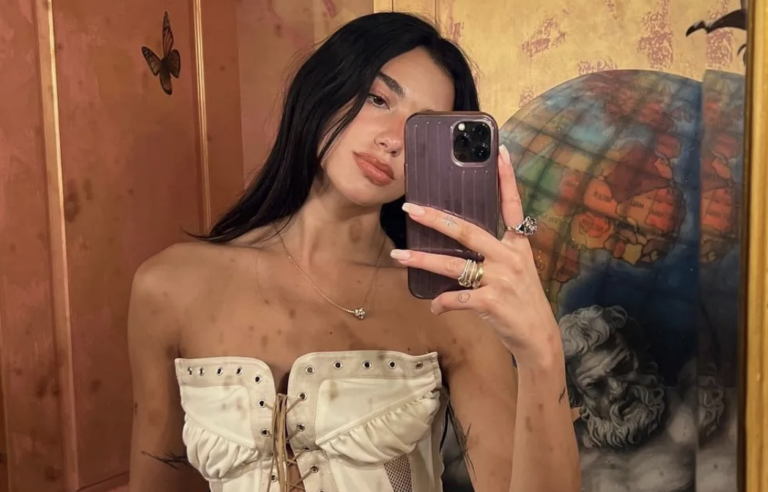 OMG! Wist jij dat Dua Lipa vroeger een kaalgeschoren hoofd had?