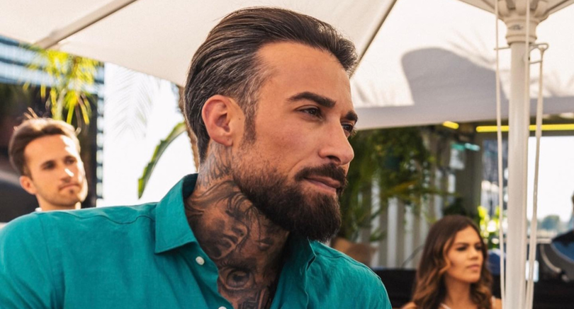 OMG: Fabrizio Tzinaridis is onherkenbaar na nieuwe ingreep