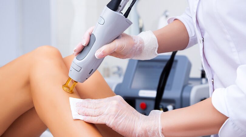 Dit zijn de belangrijkste dingen die jij moet weten over haar laseren