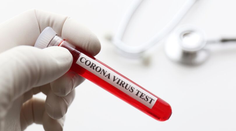 Deze Love Island-kandidaat had het coronavirus tijdens de opnames in de villa