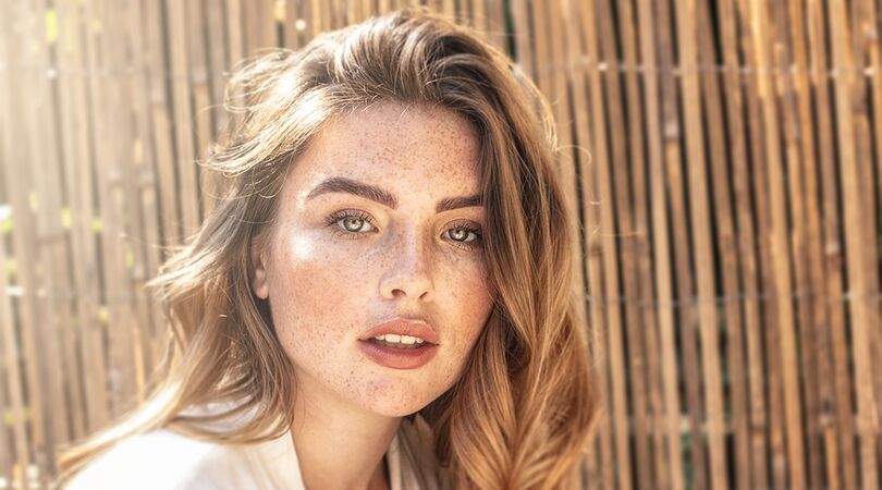 Van sproetjes tot kuiltjes in je wangen: dit zijn de 7 schoonheden