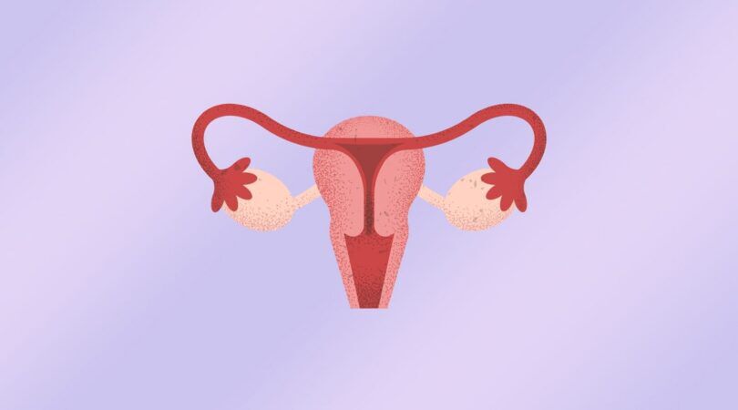 Foto van een baarmoeder.