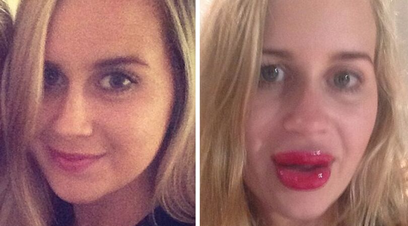 VIDEO: meisje wilde Kylie Jenner lippen (maar dit is wat ze kreeg)