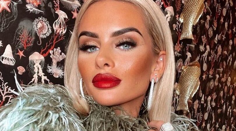 Plastic fantastic: deze ingrepen heeft Sarah van Soelen allemaal gehad