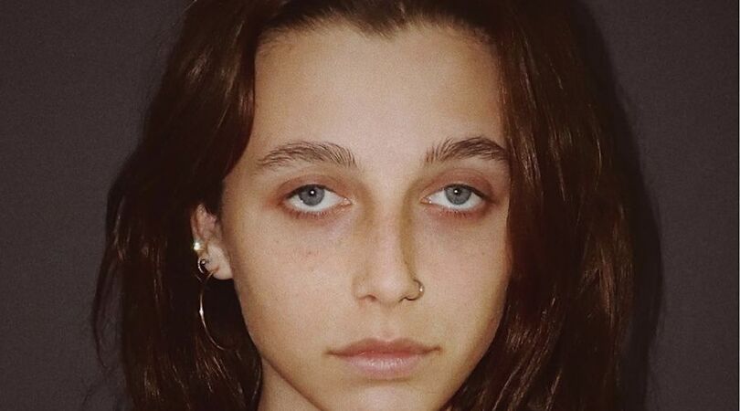 Wat? Dit is de nieuwe beauty trend: donkere kringen onder je ogen