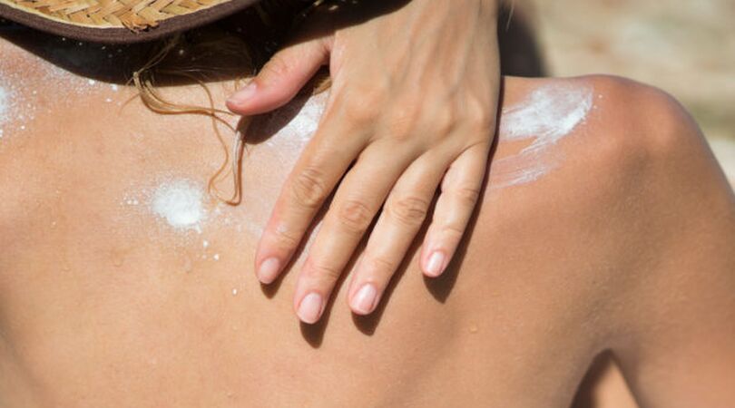 zonnebrand-gebruiken