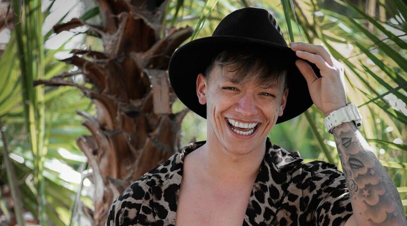 Dusty van Ex On The Beach krijgt veel negatieve reacties op zijn haartransplantatie