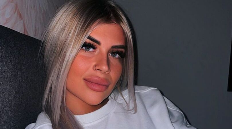 EOTB-Shani ondergaat cosmetische ingreep in Turkije