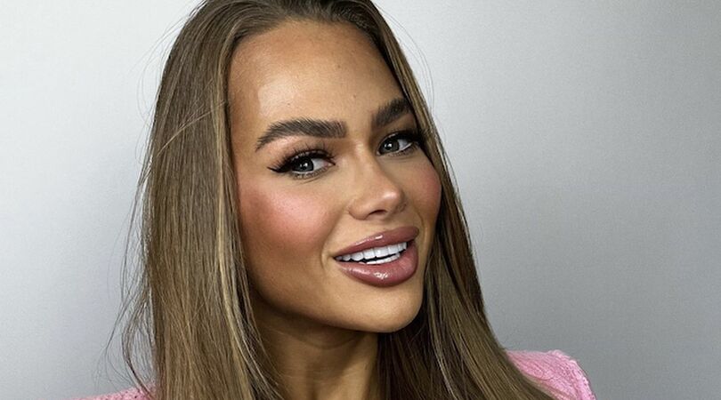 Zien! Annebel Visscher heeft (alweer) haar lippen laten doen