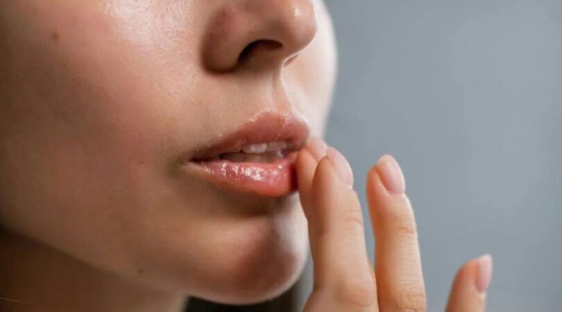 Vrouw doet lippenbalsem op haar lippen met haar hand.