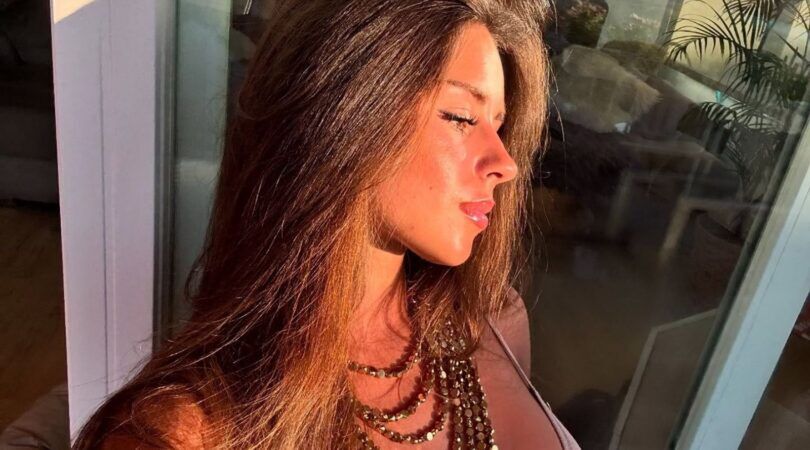 Een vrouw die lichtelijk verbrand is.