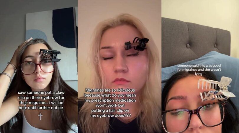 Drie vrouwen verlichten hun hoofdpijn, door een haarclip om hun wenkbrauw heen te klemmen. TikTok-hack.